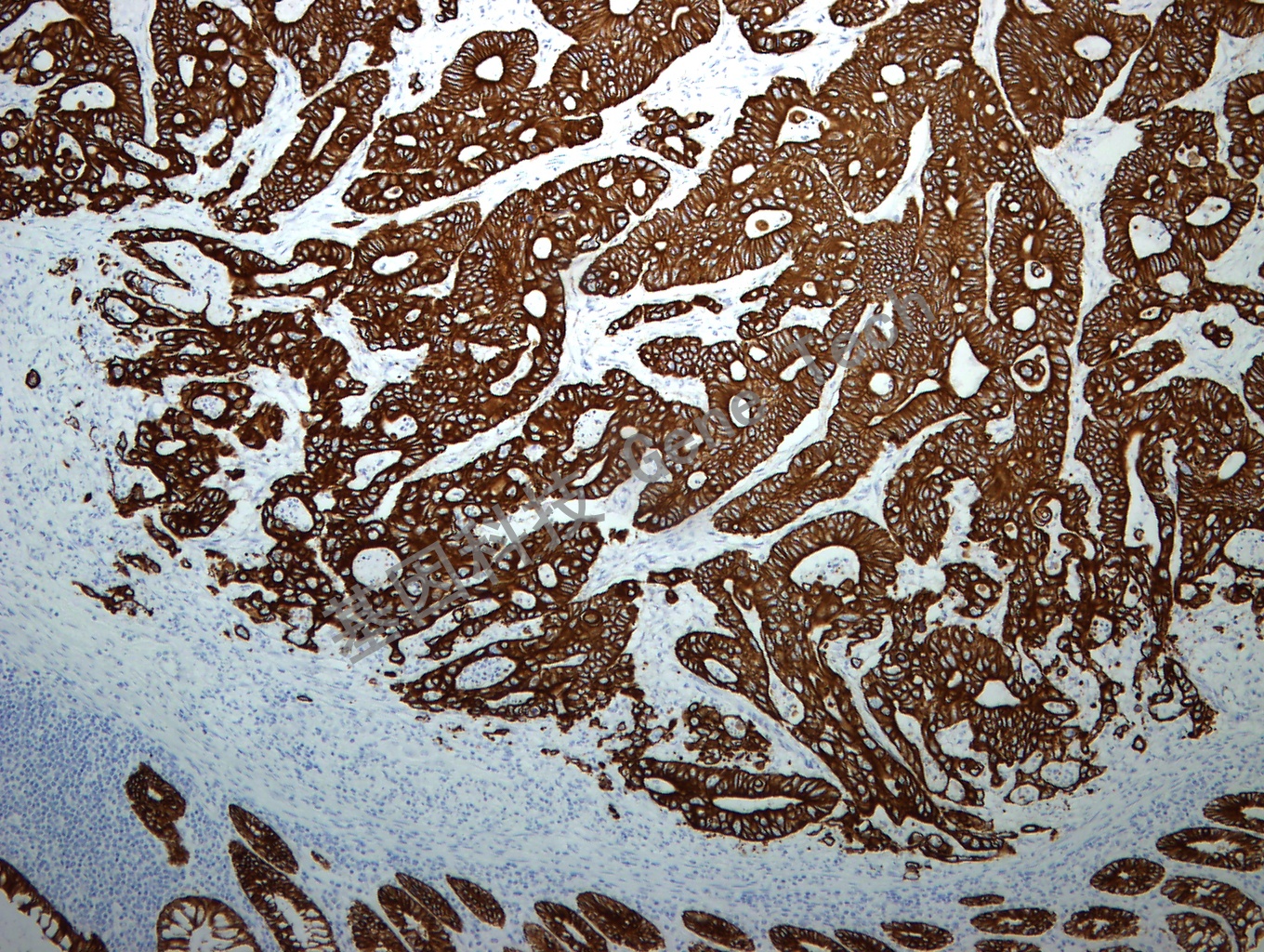 1608465711392131.jpg 1608465711392131.jpg