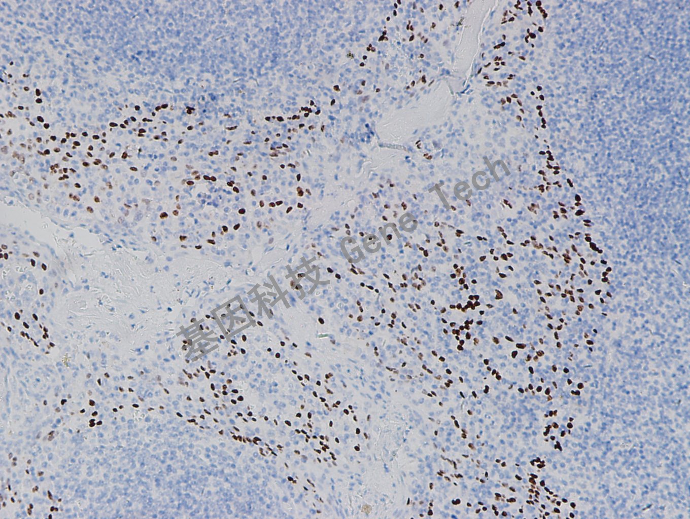 P40-扁桃體.jpg P40-扁桃體.jpg