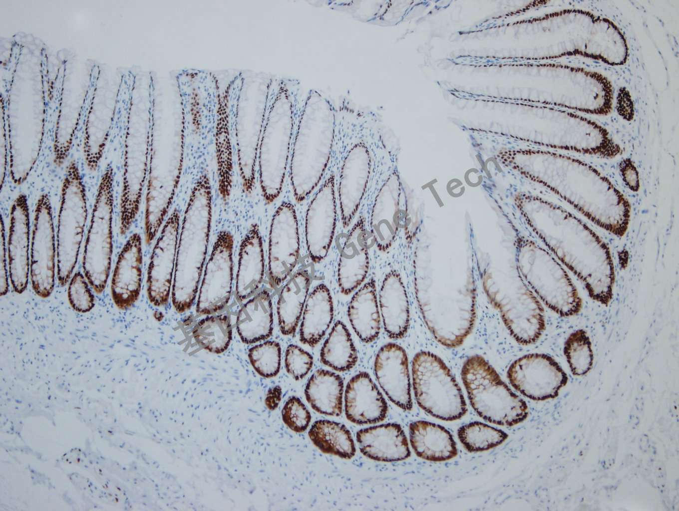 1608478124194236.jpg 1608478124194236.jpg