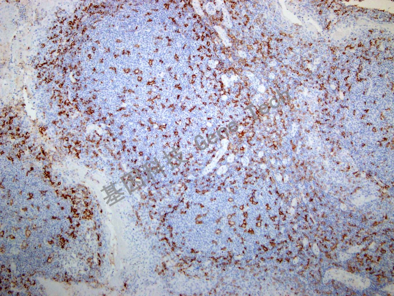 1617018597971636.jpg 1617018597971636.jpg