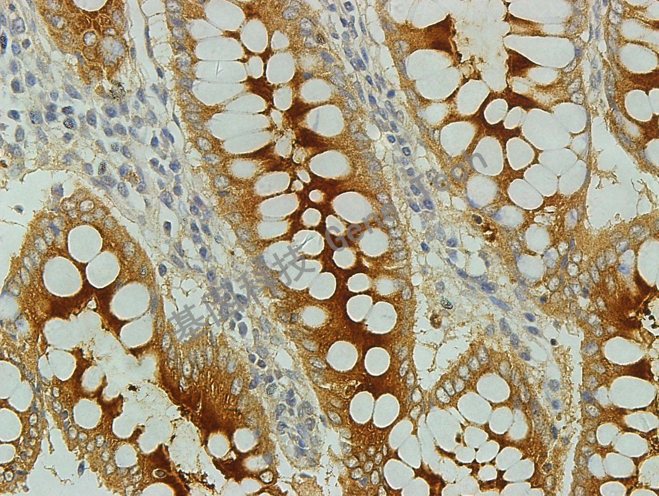 1620700499135756.jpg 1620700499135756.jpg