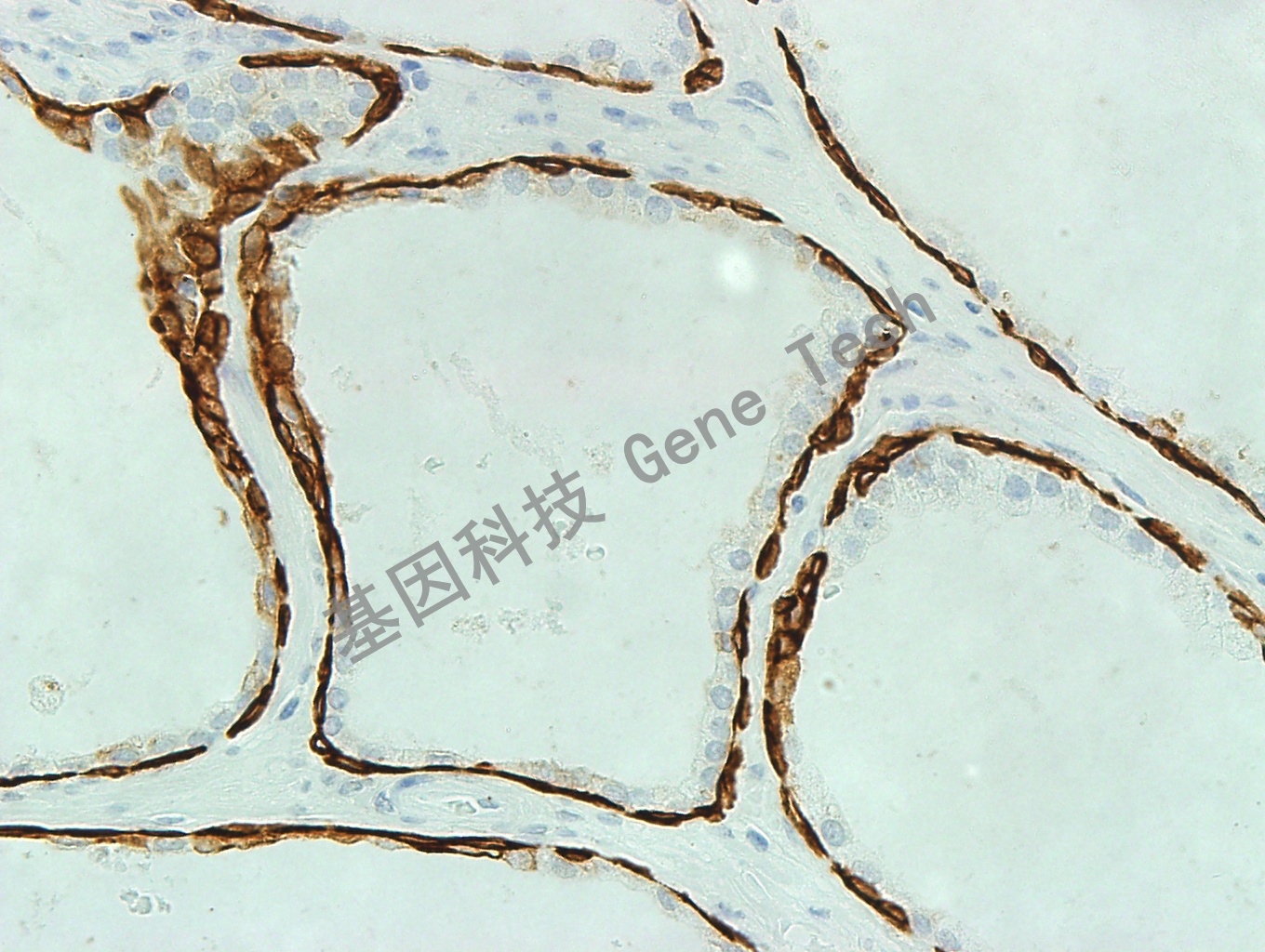 1622014802364179.jpg 1622014802364179.jpg