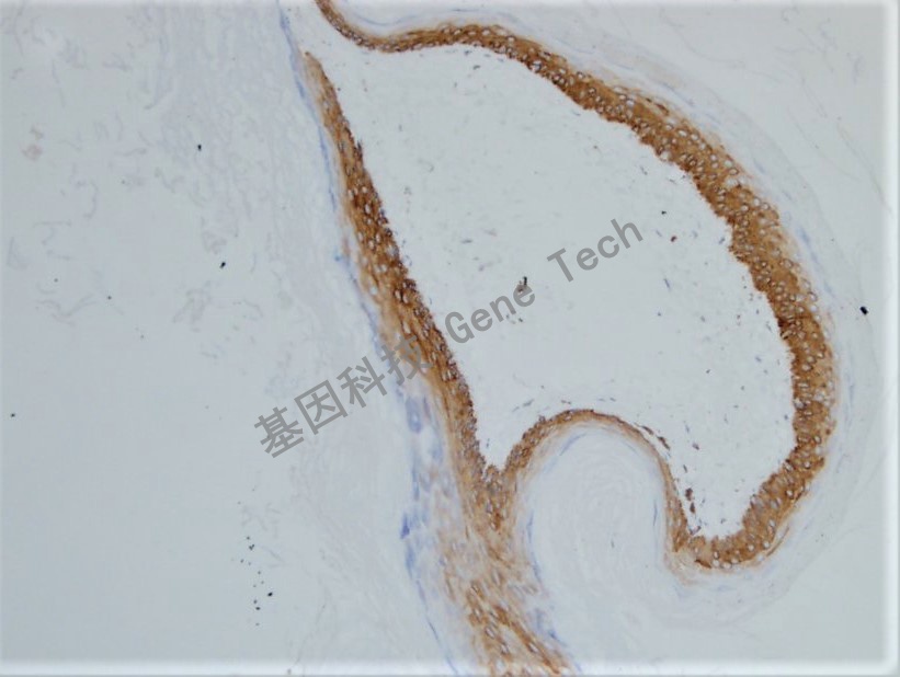 1623830737144447.jpg 1623830737144447.jpg