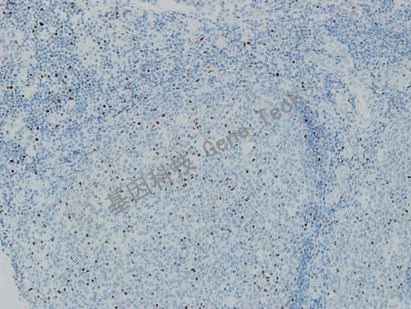 1625802923194701.jpg 1625802923194701.jpg