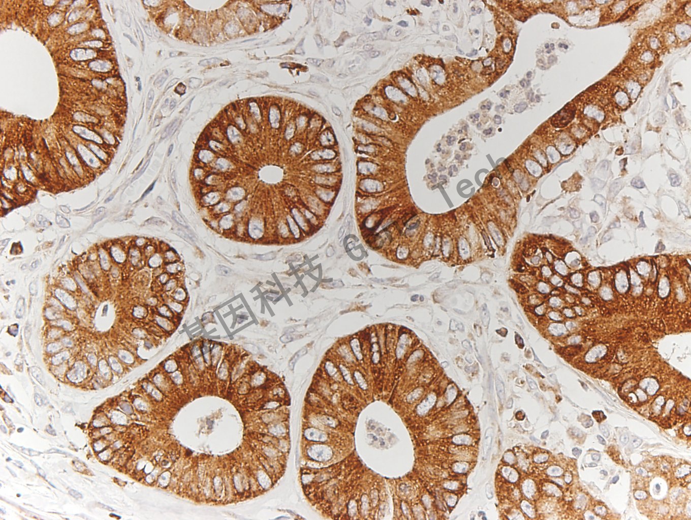 1625909550425784.jpg 1625909550425784.jpg