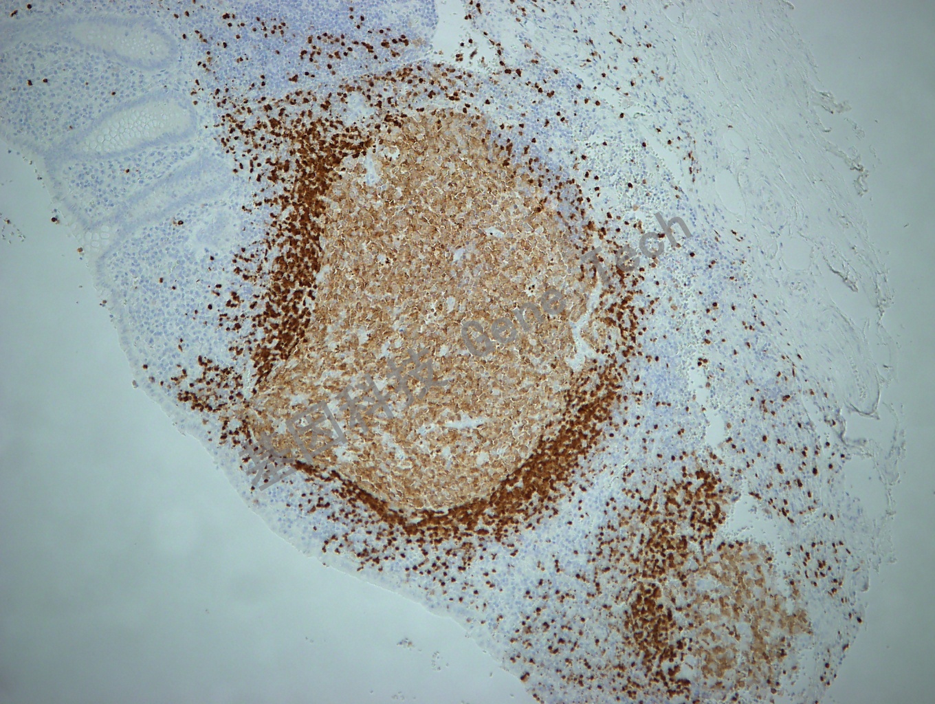 1652674799533894.jpg 1652674799533894.jpg