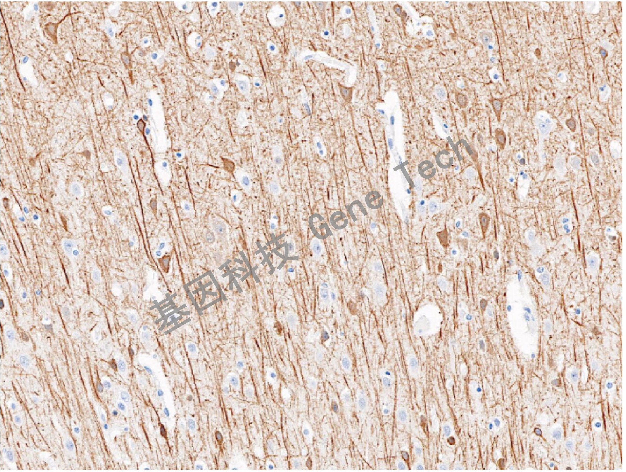 1668489804106244.jpg 1668489804106244.jpg