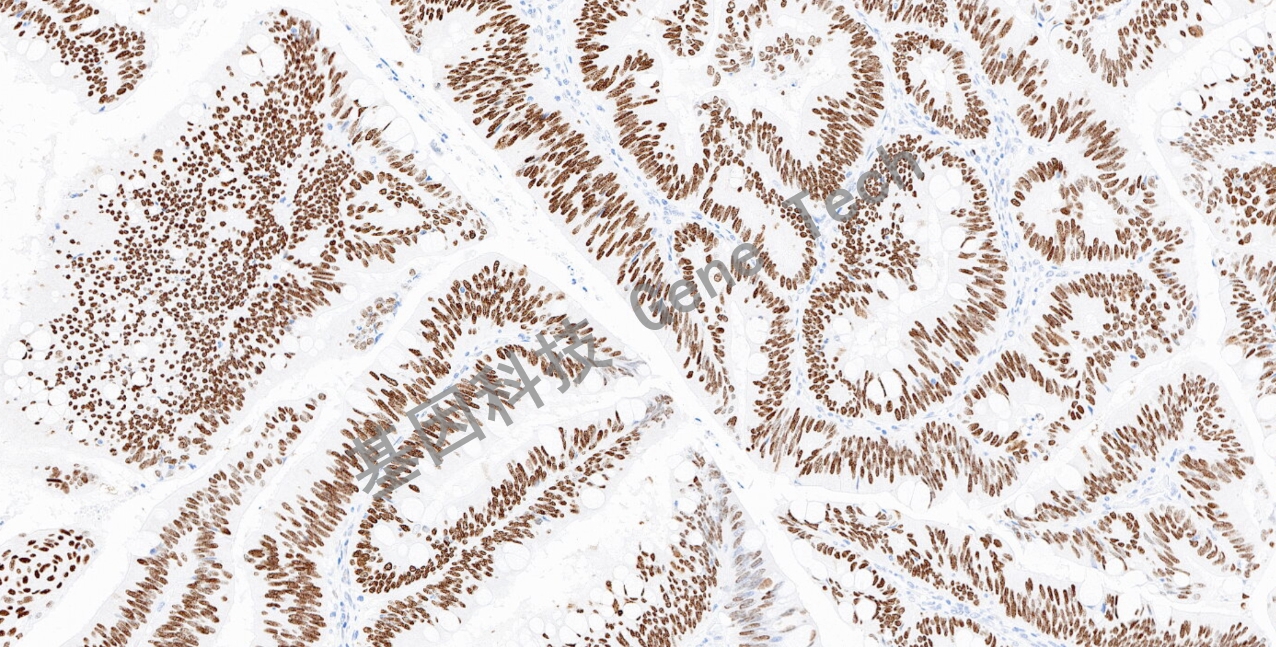 1681191481211535.jpg 1681191481211535.jpg