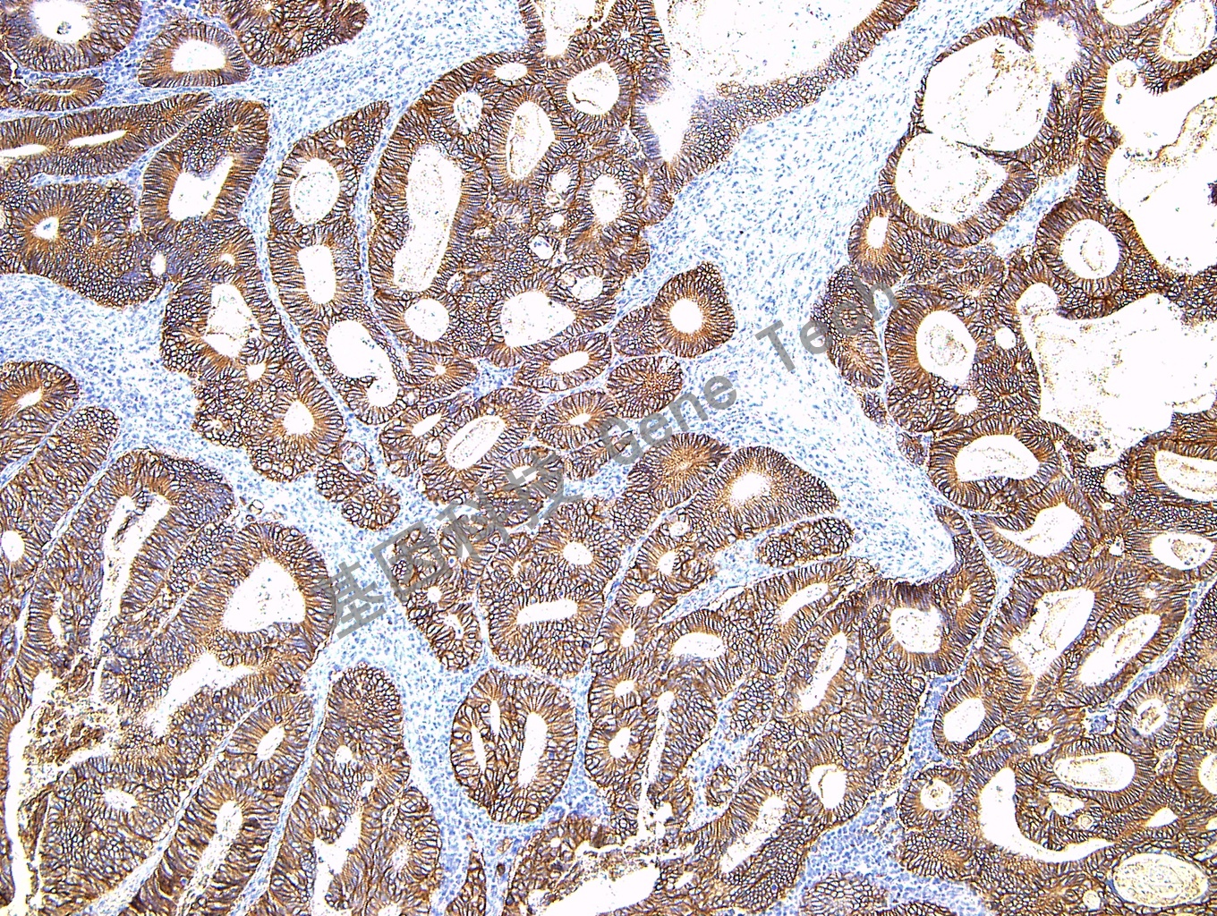 1684642086928313.jpg 1684642086928313.jpg