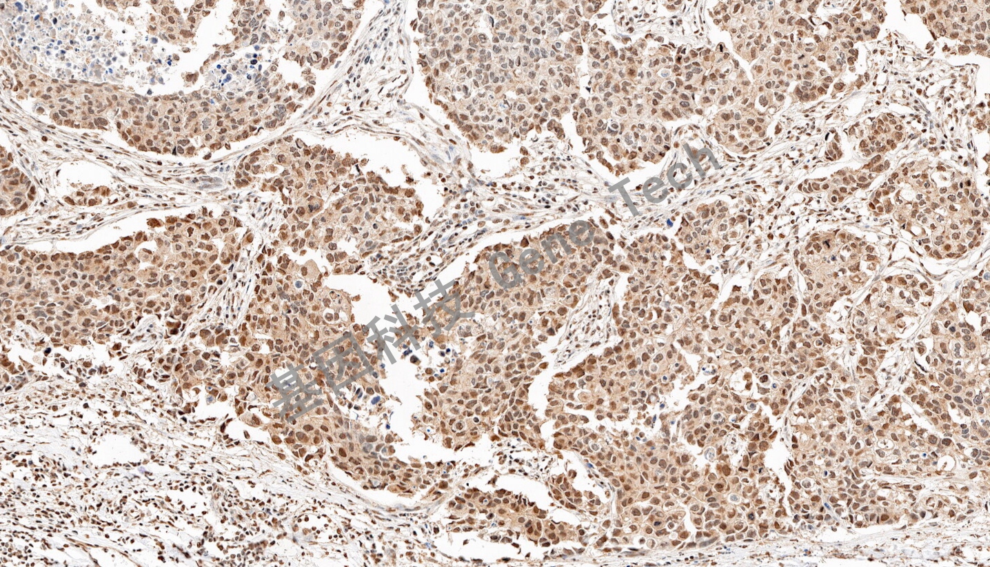 1692957951168823.jpg 1692957951168823.jpg