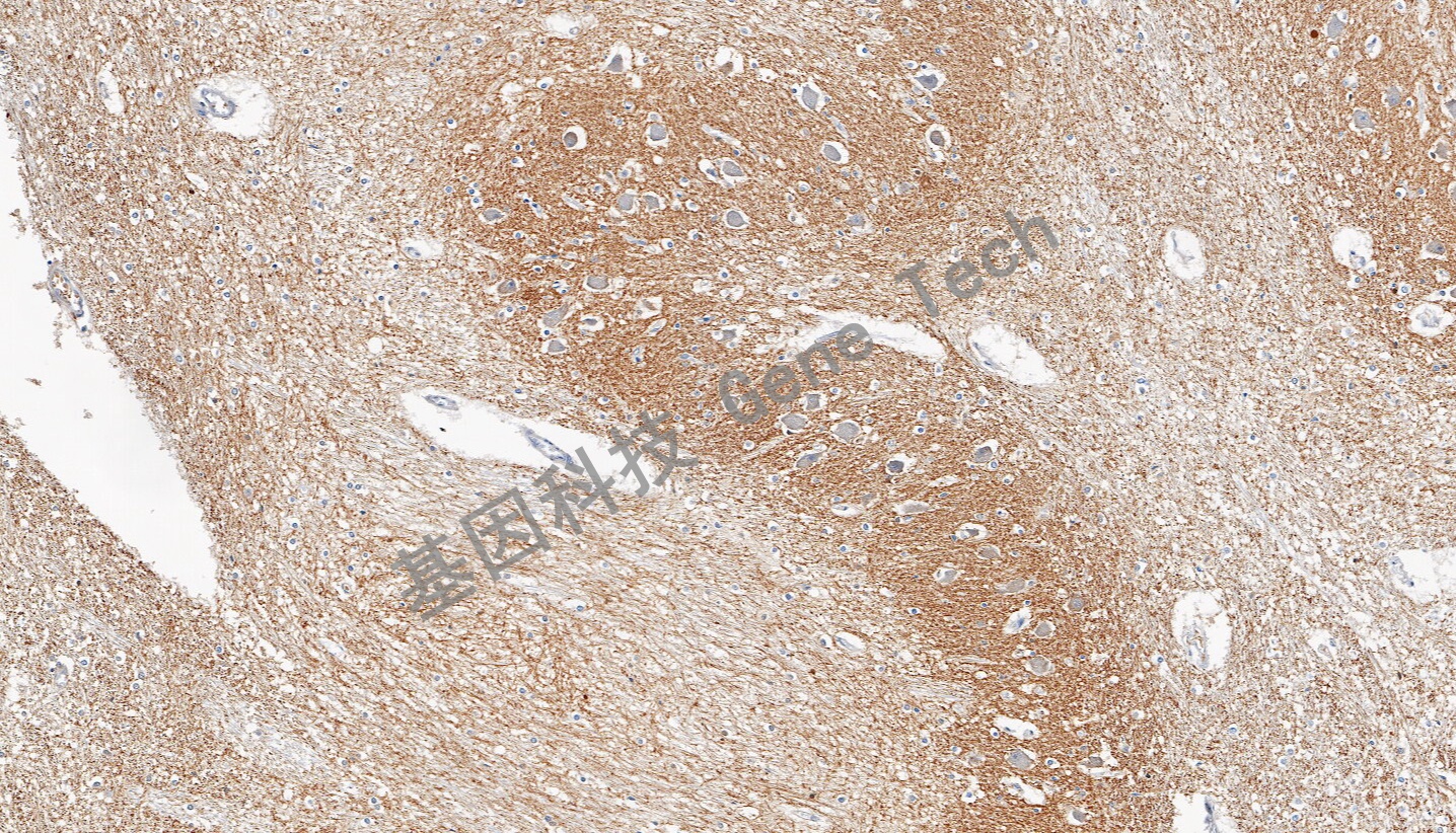 1693207008795228.jpg 1693207008795228.jpg